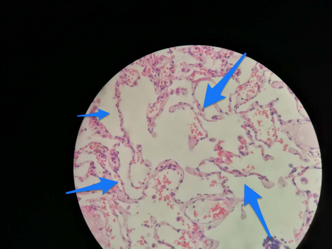 第一课肺部组织学 Radiology